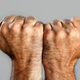 Image for article titled Most Frequently Googled Health Questions
